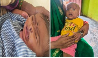 रायपुर : चिरायु योजना बच्चों के लिए भी बनी वरदान,,,   