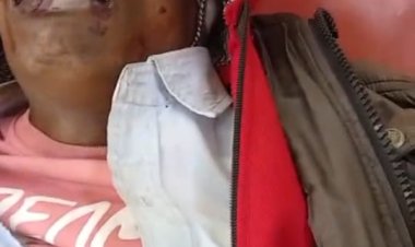 चिरमिरी पुलिस एवं एक जागरूक नागरिक की तत्परता ने बचाई एक कॉलरी कर्मी की जान